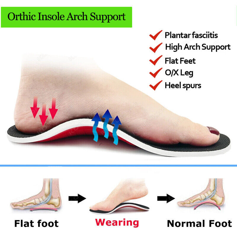 Orthotic Insoles Arch Support Flat Foot High Plantar Feet Fasciitis Pad