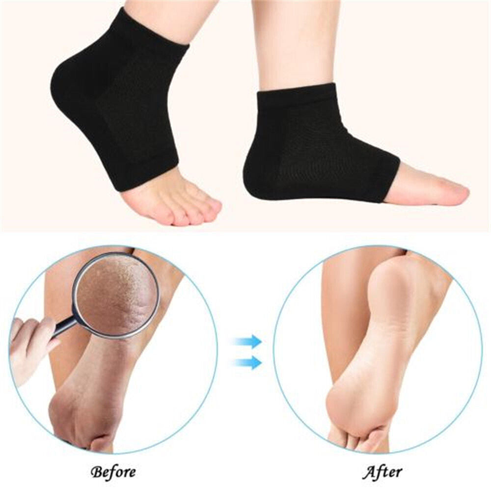 Silicone Gel Heel Socks Cracked Foot Skin Care Protector Sleeve Pain Relief