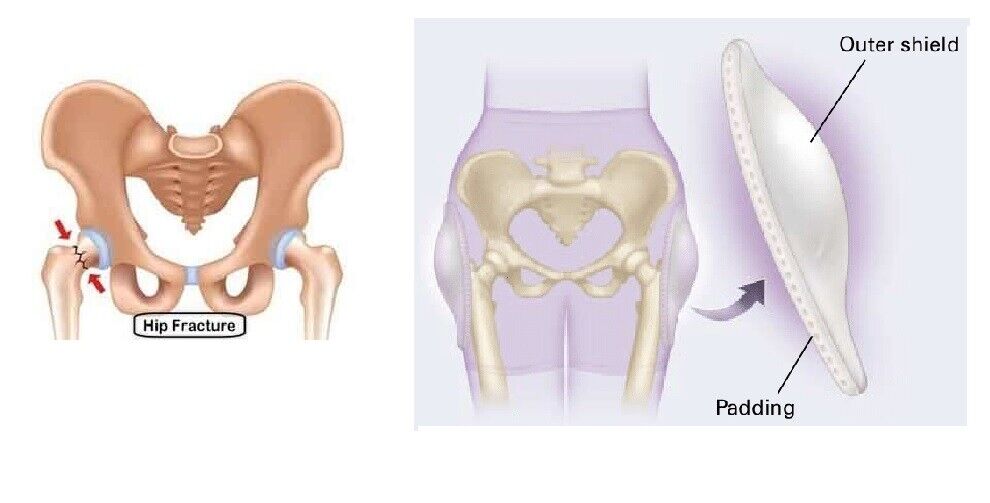 SafeHip AirX Hip Fracture Protector(Open Bottom)